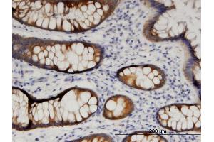 Immunoperoxidase of monoclonal antibody to ARFIP1 on formalin-fixed paraffin-embedded human colon. (ARFIP1 anticorps  (AA 1-101))