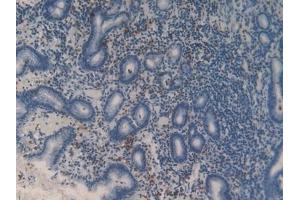 Detection of MMP9 in Human Stomach Tissue using Polyclonal Antibody to Matrix Metalloproteinase 9 (MMP9)