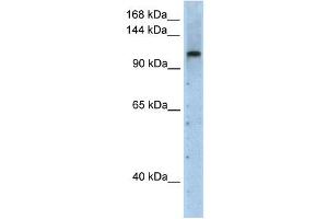PRPF6 antibody used at 2. (PRP6/ANT-1 anticorps)