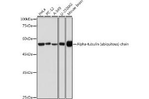 Western blot analysis of extracts of various cell lines, using Alpha-tubulin (ubiquitous) chain antibody (ABIN7271033) at 1:500 dilution. (TUBA1B anticorps  (AA 1-451))