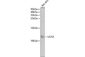 Western blot analysis of extracts of rat skin, using UCN2 antibody (ABIN6129579, ABIN6149881, ABIN6149882 and ABIN6222147) at 1:1000 dilution. (Urocortin 2 anticorps  (AA 20-112))