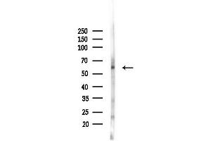 anti-Matrix Metallopeptidase 11 (Stromelysin 3) (MMP11) (N-Term) antibody