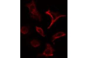 ABIN6266830 staining HeLa cells by IF/ICC. (COL4A1 anticorps)