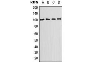 Western blot analysis of OCT2 expression in A431 (A), HepG2 (B), SP2/0 (C), H9C2 (D) whole cell lysates. (SLC22A2 anticorps  (C-Term))