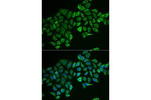 Immunofluorescence analysis of MCF-7 cells using RHOD antibody (ABIN5973862). (RHOD anticorps)