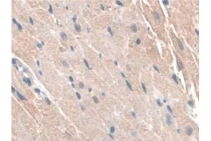 Detection of GAMT in Rat Heart Tissue using Polyclonal Antibody to Guanidinoacetate-N-Methyltransferase (GAMT)