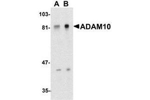 Western blot analysis of ADAM10 in Jurkat whole cell lysate with AP30017PU-N ADAM10 antibody at (A) 1 and (B) 2 μg/ml.
