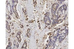 IHC analysis of Annexin A3 using anti-Annexin A3 antibody (ABIN7602989).