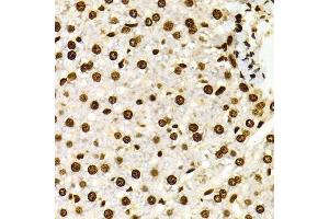 Immunohistochemistry of paraffin-embedded Rat liver using DiMethyl-Histone H3-K27 antibody.