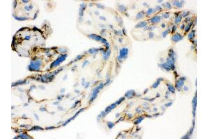 Anti- TGM2 Picoband antibody, IHC(F) IHC(F): Human Placenta Tissue