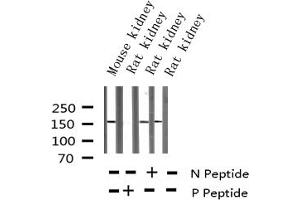 Western blot analysis of Phospho-VEGFR2 (Tyr1214) expression in various lysates