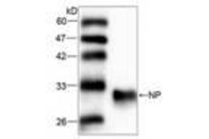 Image no. 1 for anti-Nucleoside Phosphorylase (NP) (AA 68-289) antibody (ABIN791487) (PNP anticorps  (AA 68-289))