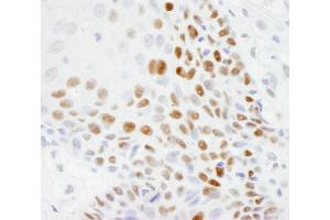 Immunohistochemistry (IHC) image for anti-Tumor Protein P53 (TP53) (AA 50-100) antibody (ABIN7448707) (p53 anticorps  (AA 50-100))
