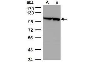 WB Image Sample(30 μg of whole cell lysate) A:293T B:A431, 7.