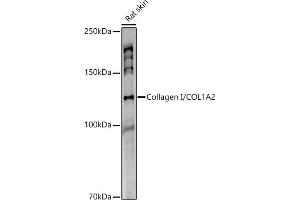 Western blot analysis of extracts of Rat skin, using Collagen I/COL1 antibody (1059) at 1:1000 dilution. (COL1A2 anticorps)