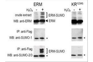 COS-7 cells were transfected for 24 hrs with a plasmid expressing FLAG-ERM (left panels) or FLAG-ERM K (right panels). (SUMO1 anticorps  (C-Term))