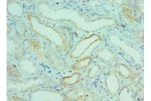 Immunohistochemistry of paraffin-embedded human kidney tissue using ABIN7145824 at dilution of 1:100 (BRD9 anticorps  (AA 338-597))