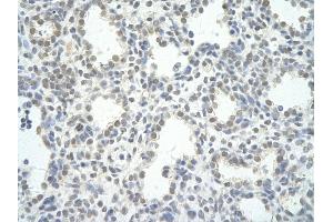 Rabbit Anti-PPP1R8 antibody   Paraffin Embedded Tissue: Human Lung cell Cellular Data: alveolar cell of renal tubule Antibody Concentration: 4.