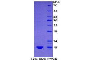 SDS-PAGE (SDS) image for Urocortin 2 (UCN2) (AA 31-112) protein (His tag) (ABIN2122310)