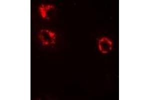 anti-Cytokine Induced Apoptosis Inhibitor 1 (CIAPIN1) antibody