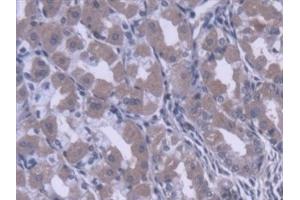 Detection of CES1 in Human Stomach Tissue using Polyclonal Antibody to Carboxylesterase 1 (CES1)