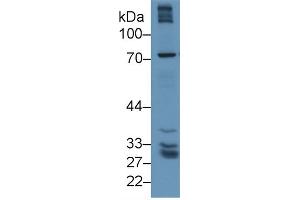 Western Blot; Sample: Human Lung lysate; Primary Ab: 1µg/ml Rabbit Anti-Human gGT5 Antibody Second Ab: 0. (GGT5 anticorps  (AA 388-586))