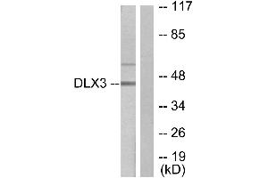 Immunohistochemistry analysis of paraffin-embedded human heart tissue using DLX3 antibody.