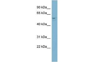 Human NCI-H226; WB Suggested Anti-ACD Antibody Titration: 0. (ACD anticorps  (Middle Region))