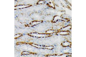 Immunohistochemistry of paraffin-embedded mouse kidney using GRIK2 Rabbit mAb (ABIN7267415) at dilution of 1:100 (40x lens).