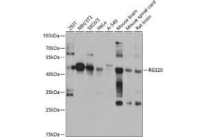 Western blot analysis of extracts of various cell lines, using RGS20 antibody (ABIN6132187, ABIN6146920, ABIN6146921 and ABIN6224191) at 1:1000 dilution. (RGS20 anticorps  (AA 1-241))