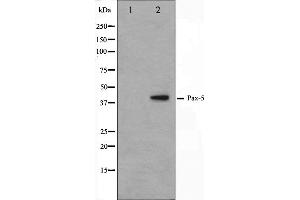 Western blot analysis on 293 cell lysate using Pax-5 Antibody. (PAX5 anticorps  (N-Term))