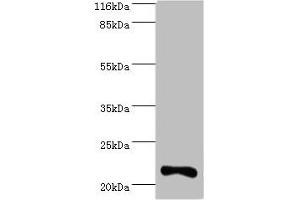 Western blot All lanes: IFNA10 antibody at 2 μg/mL + Mouse kidney tissue Secondary Goat polyclonal to rabbit IgG at 1/10000 dilution Predicted band size: 22 kDa Observed band size: 22 kDa (IFNA1 anticorps  (AA 24-189))