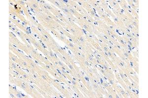 ABIN6265678 and ABIN6266689 at 1/100 staining Rat heart tissue by IHC-P. (TP53I11 anticorps  (N-Term))