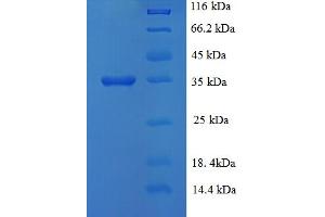 SDS-PAGE (SDS) image for Lysine (K)-Specific Demethylase 5A (KDM5A) (AA 437-603) protein (His-SUMO Tag) (ABIN5709797)