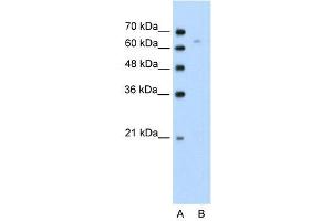 Human Jurkat; WB Suggested Anti-TOX Antibody Titration: 0. (TOX anticorps  (N-Term))