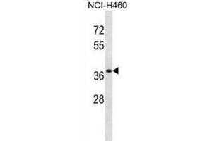Western Blotting (WB) image for anti-CutC Copper Transporter Homolog (CUTC) antibody (ABIN2999019) (CUTC anticorps)