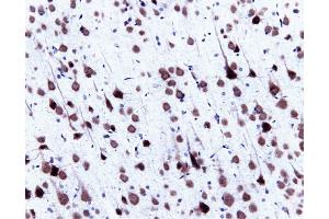 Immunohistochemical staining of pyrimidal cells in a rat cortex, formalin-fixed paraffin-embedded tissue section, with citrate pre-treatment (magnification, 20X). (SNRPN anticorps  (AA 14-174))