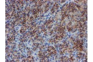 Image no. 6 for anti-Signal Recognition Particle Receptor, B Subunit (SRPRB) antibody (ABIN1501126)