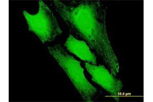 Immunofluorescence of purified MaxPab antibody to PFDN5 on HeLa cell.