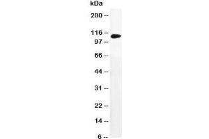 Western blot testing of DPYD antibody and MM231 cell lysate (DPYD anticorps  (AA 33-52))