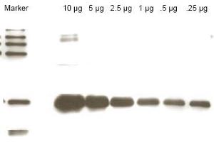 Western blot using anti-Yeast ULP-1 antibody shows detection of a truncated ULP-1 fusion protein (arrowhead). (ULP1 anticorps)