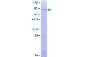 Image no. 1 for Interferon Regulatory Factor 4 (IRF4) (AA 1-451) protein (GST tag) (ABIN1308086)