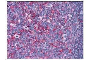 Human Tonsil: Formalin-Fixed, Paraffin-Embedded (FFPE) (Flotillin 2 anticorps  (C-Term))