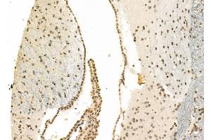 ABIN6260297 and ABIN6278198 at 1/100 staining Mouse brain tissue by IHC-P.