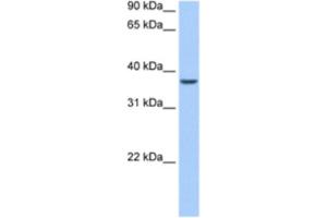 Western Blotting (WB) image for anti-AlkB, Alkylation Repair Homolog 8 (ALKBH8) antibody (ABIN2462329)