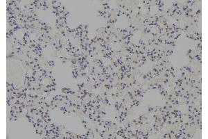 ABIN6277745 at 1/100 staining Rat lung tissue by IHC-P. (MDM4-binding Protein anticorps  (Internal Region))