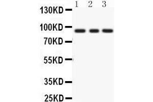 Western Blotting (WB) image for anti-Protein Kinase C, epsilon (PRKCE) (AA 53-236) antibody (ABIN3043908) (PKC epsilon anticorps  (AA 53-236))
