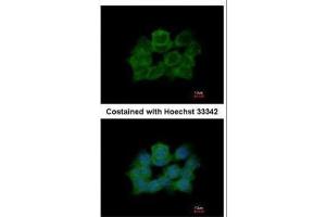 ICC/IF Image Immunofluorescence analysis of paraformaldehyde-fixed A431, using ABR, antibody at 1:500 dilution. (ABR anticorps  (C-Term))