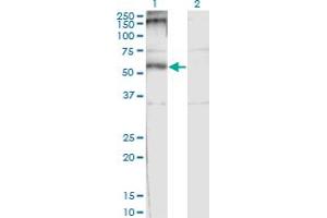 Western Blot analysis of CHRND expression in transfected 293T cell line by CHRND monoclonal antibody (M01), clone 2B2. (CHRND anticorps  (AA 24-130))