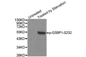 Western blot analysis of extracts from 293 cells, using Phospho-G3BP1-S232 antibody (ABIN2988019). (G3BP1 anticorps  (pSer232))